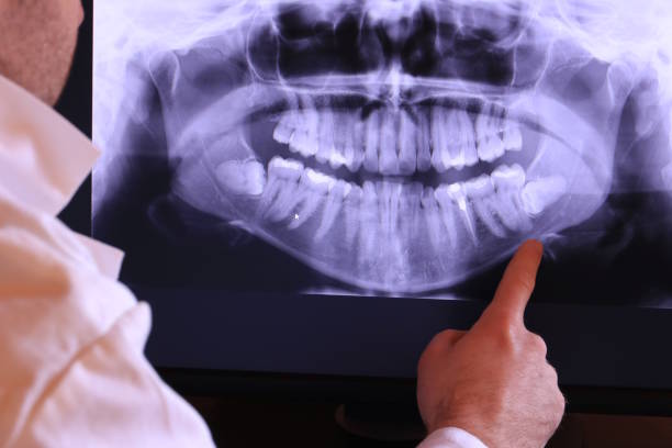 Best Urgent Dental Care for Toothache in Crocker, WA
