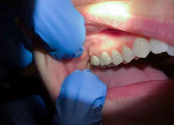 Best Pediatric Emergency Dentist in Crocker, WA