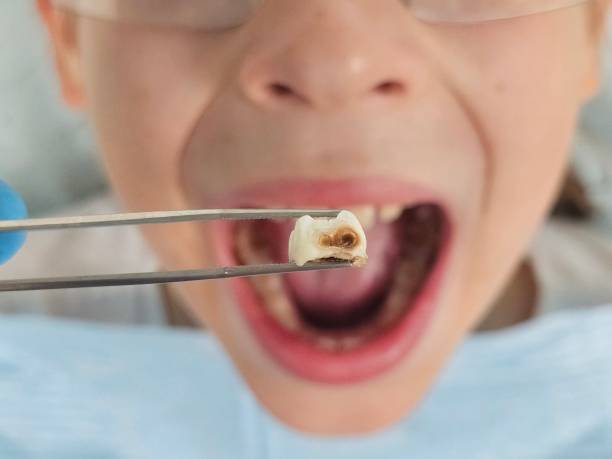 Best Emergency Cosmetic Dentistry in Crocker, WA